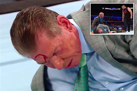 Wwe Vince Mcmahons Head Split Open By Kevin Owens On Smackdown