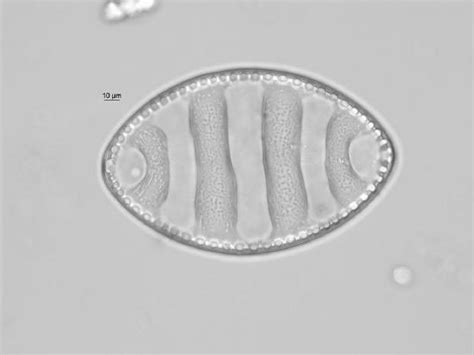 44 Diatoms Biology Libretexts