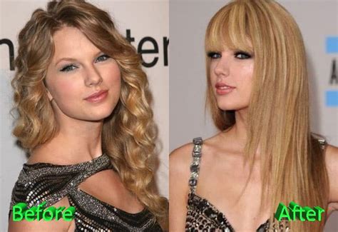Taylor Swift Plastic Surgery Before Fame