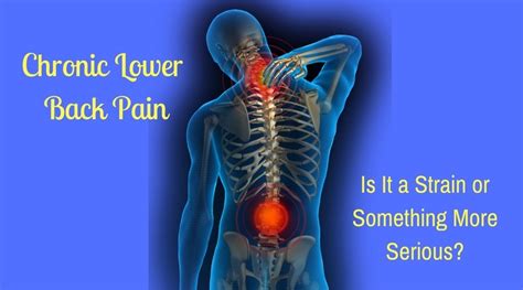 Chronic Lower Back Pain Is It A Strain Or Something More Serious