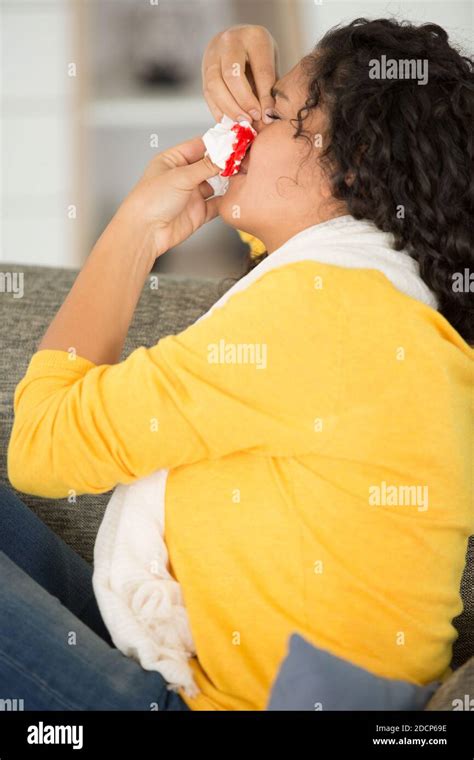 Bloody Nose Hi Res Stock Photography And Images Alamy