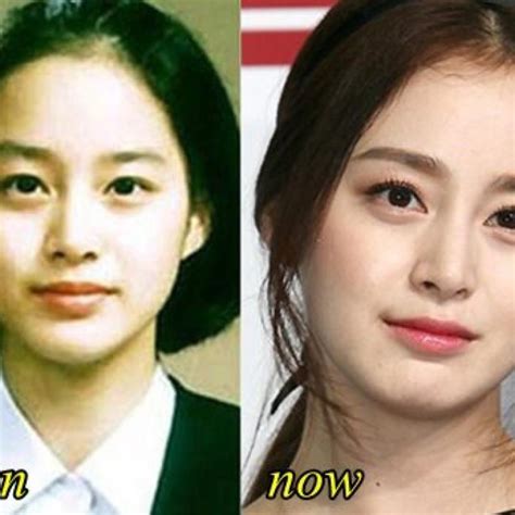 Kim tae hee plastic surgery before and after. Inilah Sosok Rain Kim Tae Hee Yang Akan Bulan Madu Ke Bali ...