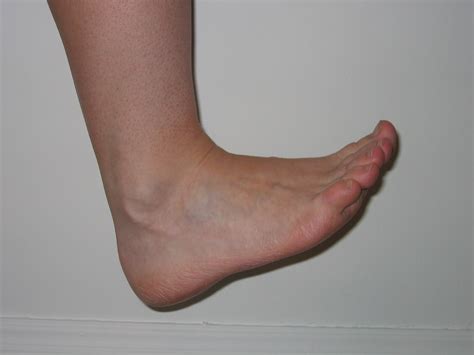 The muscles acting on the foot can be divided into two distinct groups; Foot. Causes, symptoms, treatment Foot
