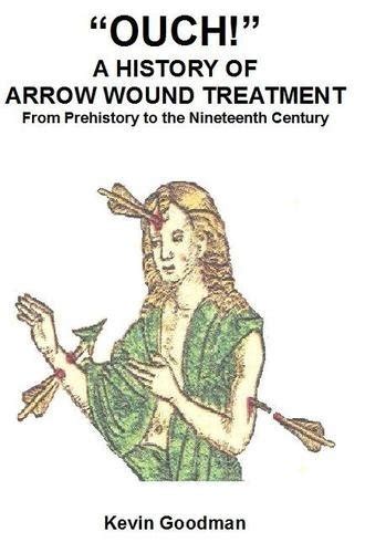 Ouch A History Of Arrow Wound Treatment From Prehistory To The