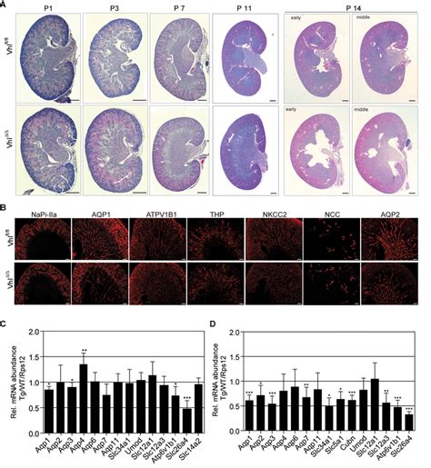 Hydronephrosis In Vhl Deficient Mice Forms Between Postnatal Days 11