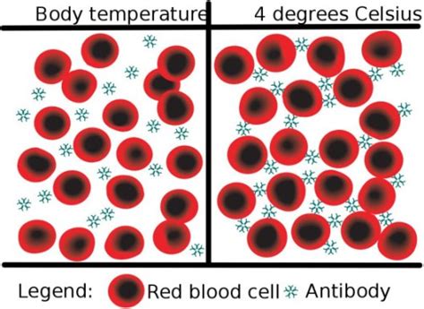 Perfusion Policies 101 Cold Agglutinins