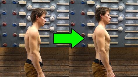 Correcting Climbers Back 3 Exercises Youtube