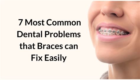 7 Most Common Dental Problems That Braces Can Fix Easily Vistadent