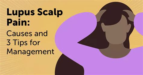 Lupus Scalp Pain Causes And 3 Tips For Management Mylupusteam