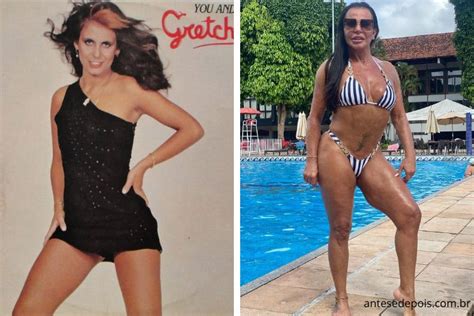 Gretchen Antes E Depois Saiba As Cirurgias Feitas