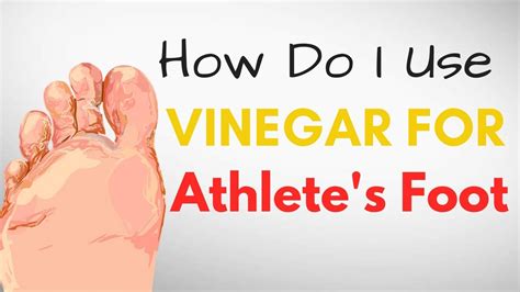 How Do I Use Vinegar For Athletes Foot Treatment 9 Best Remedies