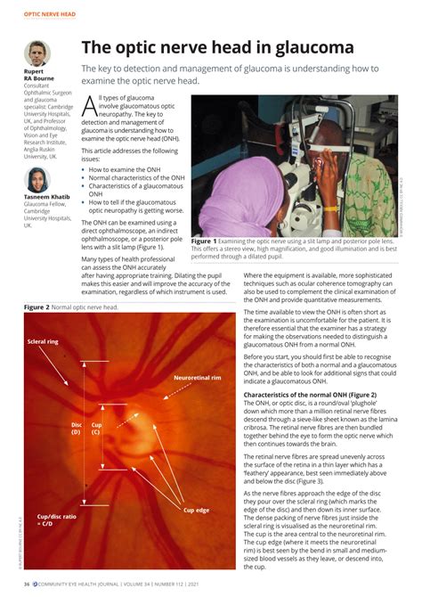 Pdf The Optic Nerve Head In Glaucoma