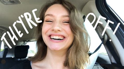 Fortunately, dentists have spent generations learning how to fix this, and now overbite correction is the second most common reason people choose to get braces. I GOT MY BRACES OFF!! // deep overbite, crowding, bite ...
