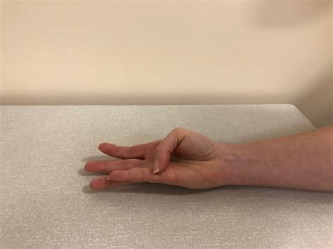 Hand Therapy Exercises Following Extensor Pollicis Longus Epl