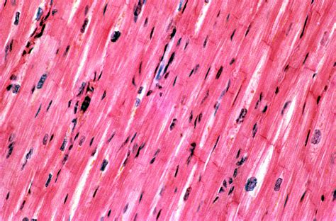 Light Micrograph Of Cardiac Muscle Photograph By Astrid And Hanns Frieder