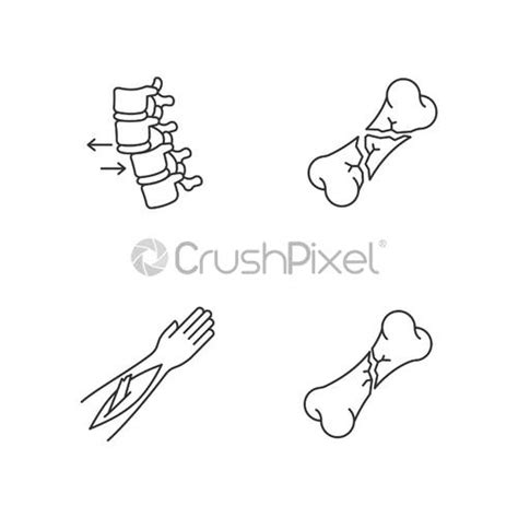 Bone Fractures Pixel Perfect Linear Icons Set X Ray Scan Stock Vector