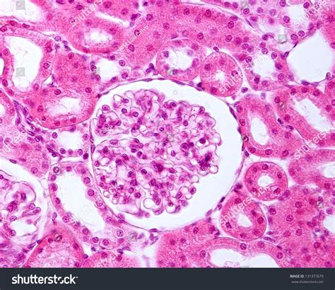 Bowmans Capsule Histology Over 30 Royalty Free Licensable Stock Photos