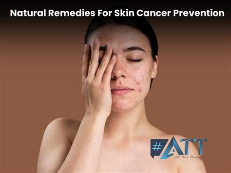 Natural Remedies For Skin Cancer All That Trending