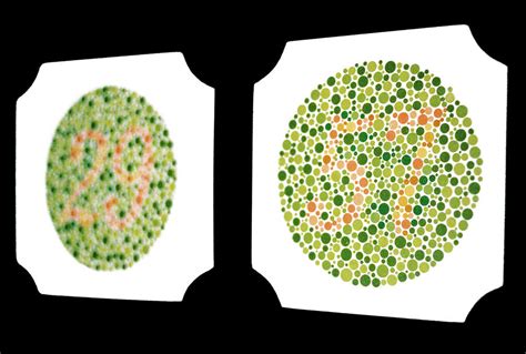 Colour Blindness Test Photograph By Annabella Blueskyscience Photo