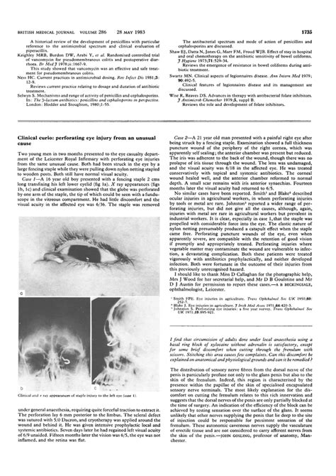 Clinical Curio Perforating Eye Injury From An Unusual Cause The Bmj