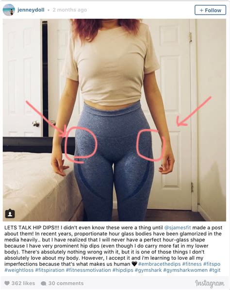 What Are Hips Dips And Why You Should Embrace Your Perfectly Imperfect