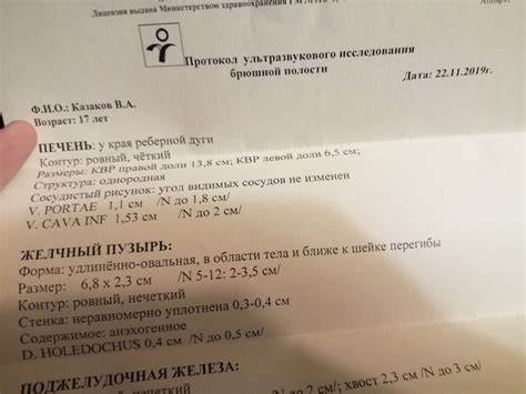 Хороший результат диет