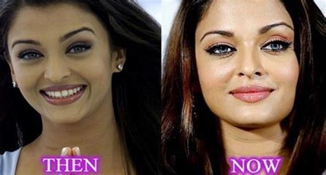 Bollywood Actress Plastic Surgery