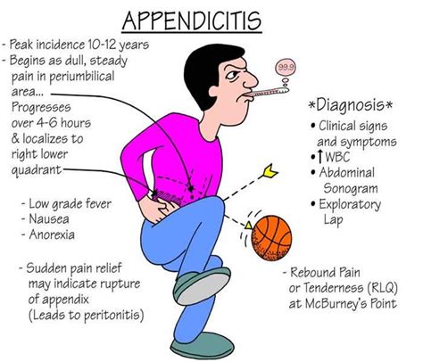 Appendicitis Causes Symptoms Treatment Diagnosis And Prevention