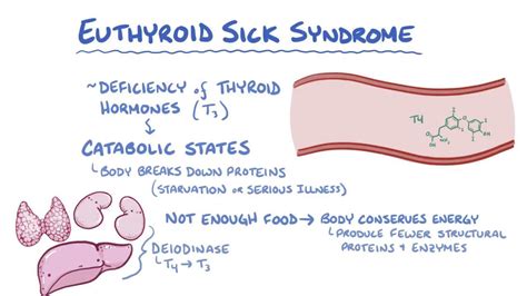 Euthyroid Sick Syndrome Video Anatomy And Definition Osmosis