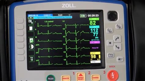 National Ems Week Cardiac Monitor Youtube