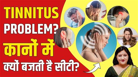 Tinnitus Treatment How To Cure Tinnitus By Acupressure Points Dr