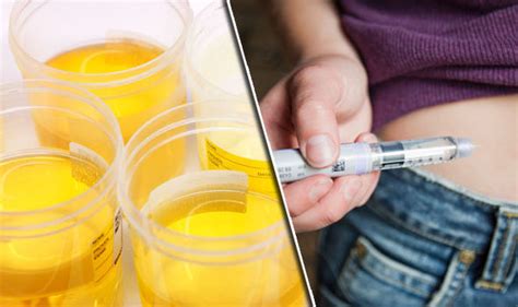 Urine Smell Warning Sweet Scent After Going To Toilet A Symptom Of