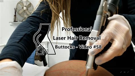 professional laser hair removal buttocks video 58 youtube
