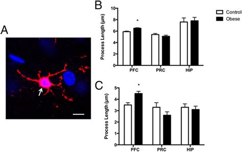 Obesity Increased The Length Of Microglial Processes In Pfc Confocal