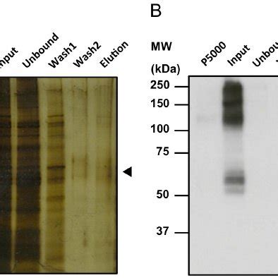 SDS PAGE Silver Staining And Western Blot Analyses HGLUT9b