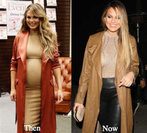 Chrissy Teigen Plastic Surgery Before And After Photos Latest Plastic