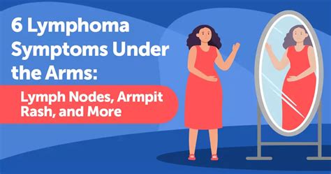 6 Lymphoma Symptoms Under The Arms Lymph Nodes Armpit Rash And More