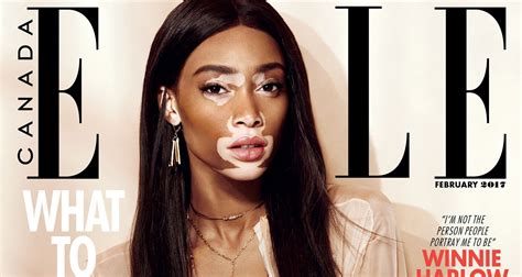 Winnie Harlow Prefers To Be Called An Inspiration Not A Role Model