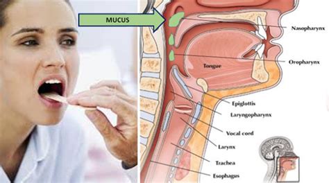 Gerd can also cause a dry cough and bad breath. Get Rid of Throat Mucus Faster With These Home Treatments ...