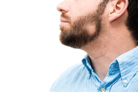 The Ultimate Guide To Beard Bald Spots Particle