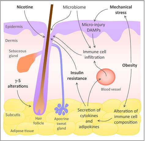 Aetiology And Pathogenesis Of Hidradenitis Suppurativa Wolk 2020