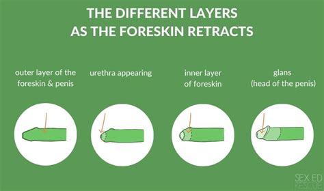How To Keep Your Foreskin Retracted Treatytheory1