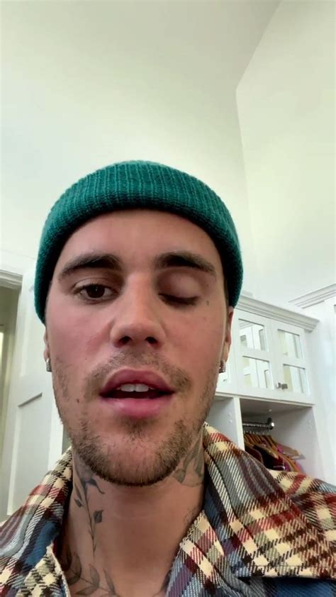 Pop Crave On Twitter Justin Bieber Reveals He Is Suffering From