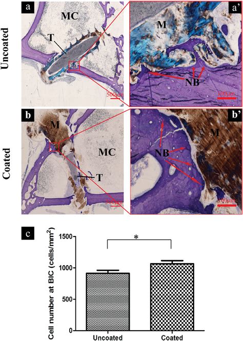 Toluidine Blue Staining 26 Weeks After Implantation For Hard Tissue Download Scientific Diagram