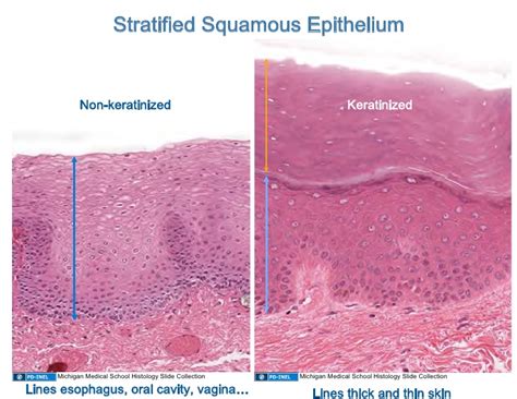 Stratified Squamous Epithelial Tissue | hairstylegalleries.com