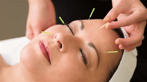 What Are The Long Term Benefits Of Acupuncture