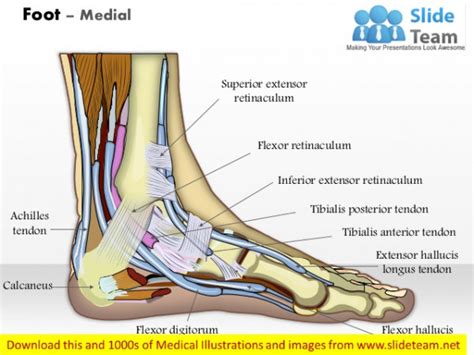 Hi, i have had extensor tendonitis in my feet for nearly a year now.due to over use at work. retinaculum release tear foot ankle