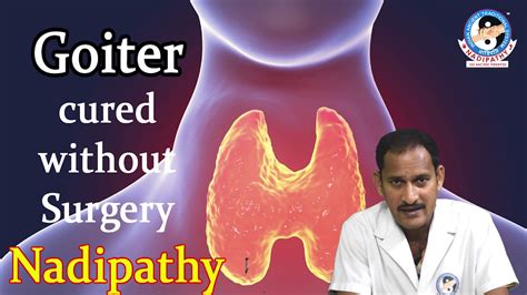 How To Cure Goiter Naturally With Drkrishnam Raju Nadipathy With Cc