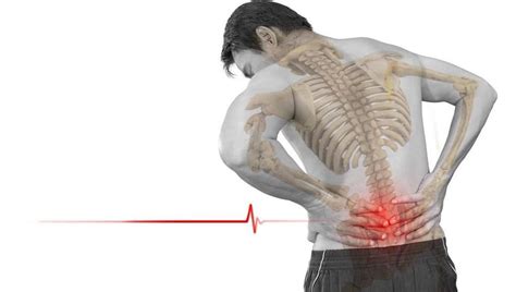 Non Specific Back Pain Archives Spinal Backrack