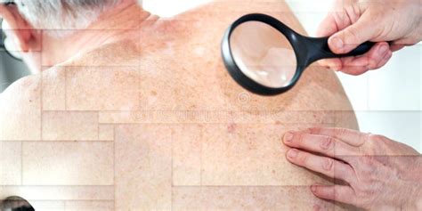 Dermatologist Examining The Skin Of A Patient Geometric Pattern Stock